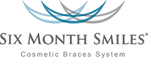 Six Months Smiles Cosmetic Braces System 