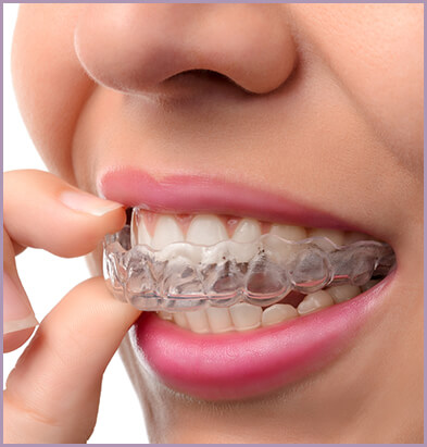 Woman removing invisible teeth aligner revealing straight teeth