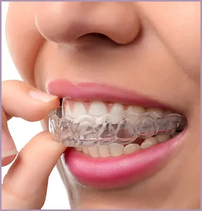 Cumming Invisalign