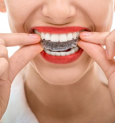 a woman holding clear aligners